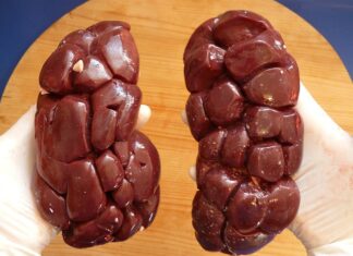 Czy nerka jest bagażem podręcznym?